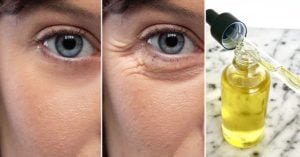 serum-vitamine-a-anti-rides